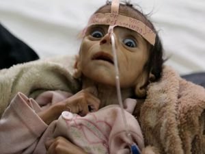 Yemen'de her 10 dakikada bir çocuk ölüyor