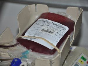 Talasemi hastalarının en büyük sorunu: Kan nakli