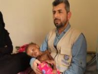 "Yemen tarihinin en kötü zamanını yaşıyor"