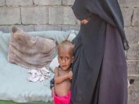 BM'den Yemen uyarısı: Halkın yüzde 40'ı gıda sıkıntısı yaşıyor