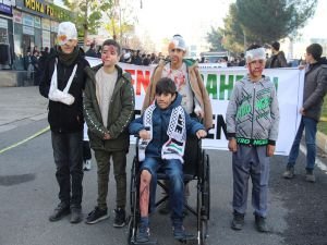 Diyarbakırlı çocuklar: Aynadan bakarken onların çektiği acıyı hissediyoruz