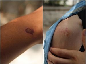 Darbe karşıtı gençler polis tarafından darp edildi