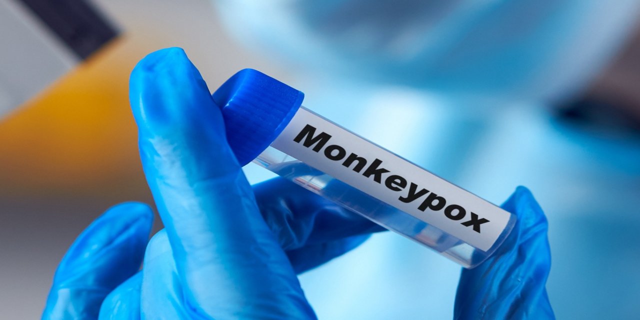 Uganda'da mpox'tan ölenlerin sayısı 40'a yükseldi