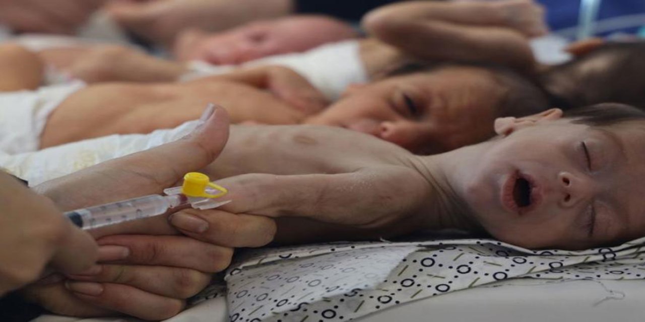 Siyonist işgalciler Gazze'de bir bebeği daha açlıktan öldürdü