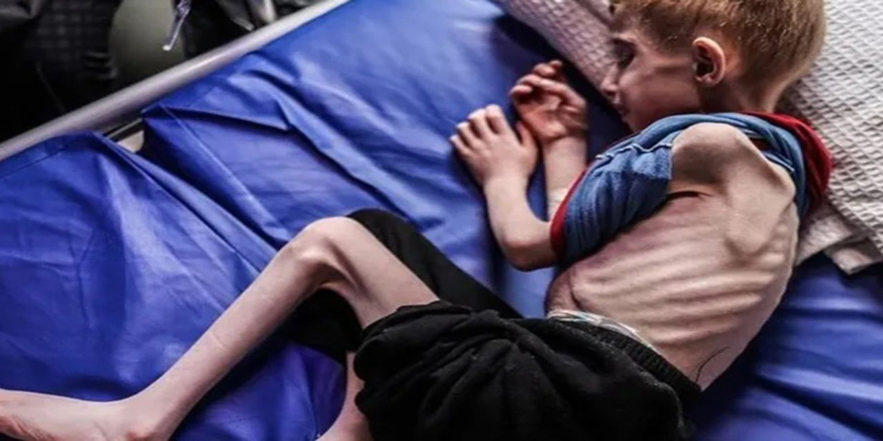 Gazze'de açlık ve ilaçsızlıktan can kayıpları artıyor