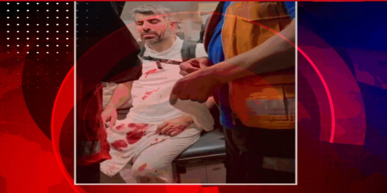 HÜDA PAR Milletvekili Faruk Dinç, Mısır’da saldırıya uğradı