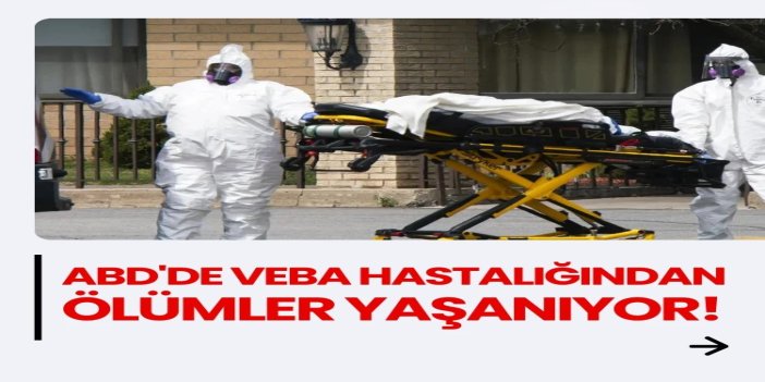 ABD'de veba kaynaklı ölüm bildirildi