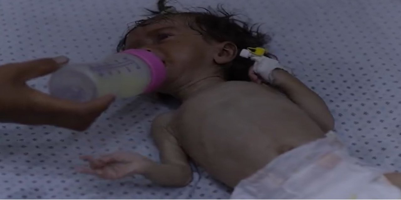 UNICEF: Haziranda Gazze'de 5 bin 800’den fazla çocuk yetersiz beslenme yaşadı