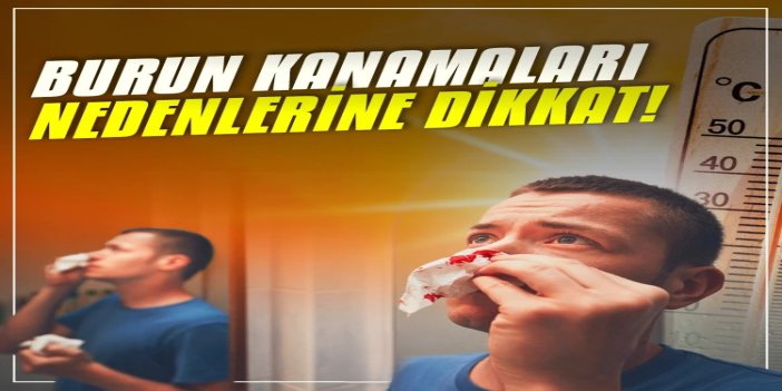Sıcak havalarda burun kanamaları nedenlerine dikkat!