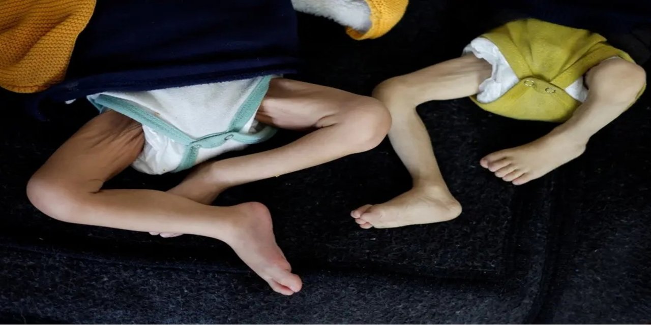 Gazze'de son 24 saatte 2’si çocuk 9 Filistinli açlıktan can verdi