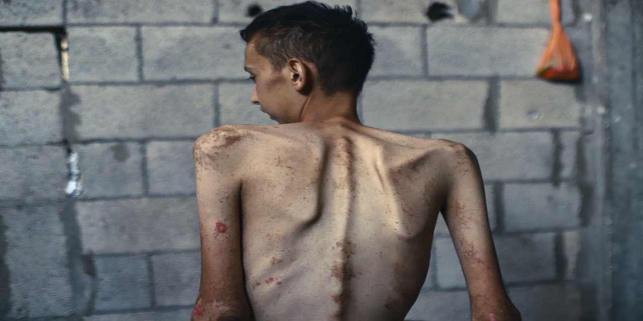 Gazze'de açlık felaketi: 106'sı çocuk 235 şehit