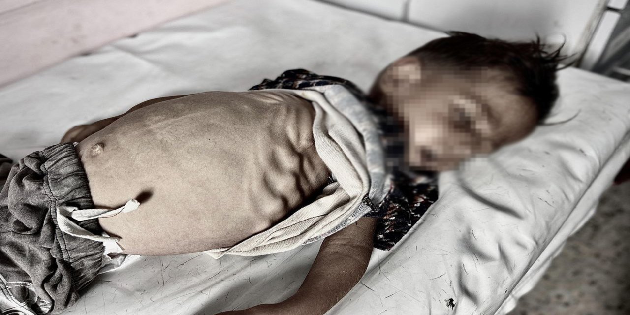 Gazze'de açlıktan ölümler artıyor: 2'si çocuk 4 kişi daha hayatını kaybetti