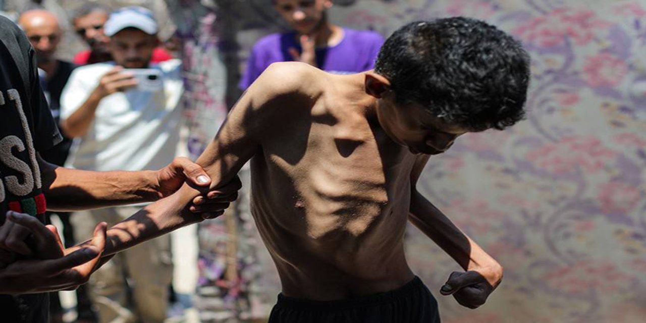 Gazze’de son 24 saatte açlıktan 2 kişi daha şehit oldu