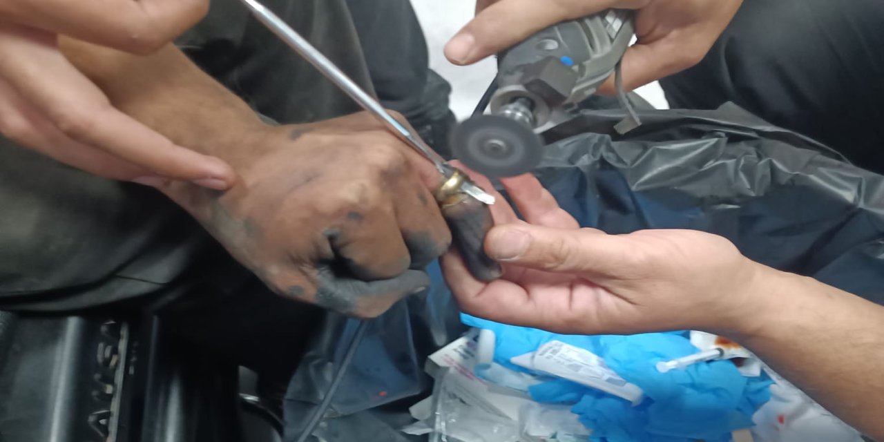 Batman'da parmakta sıkışan yüzük operasyonla çıkarıldı