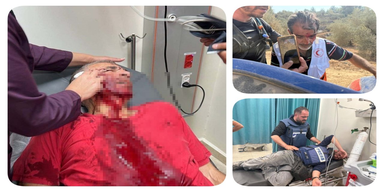 Yahudi çetelerden Filistinli çiftçilere vahşi saldırı