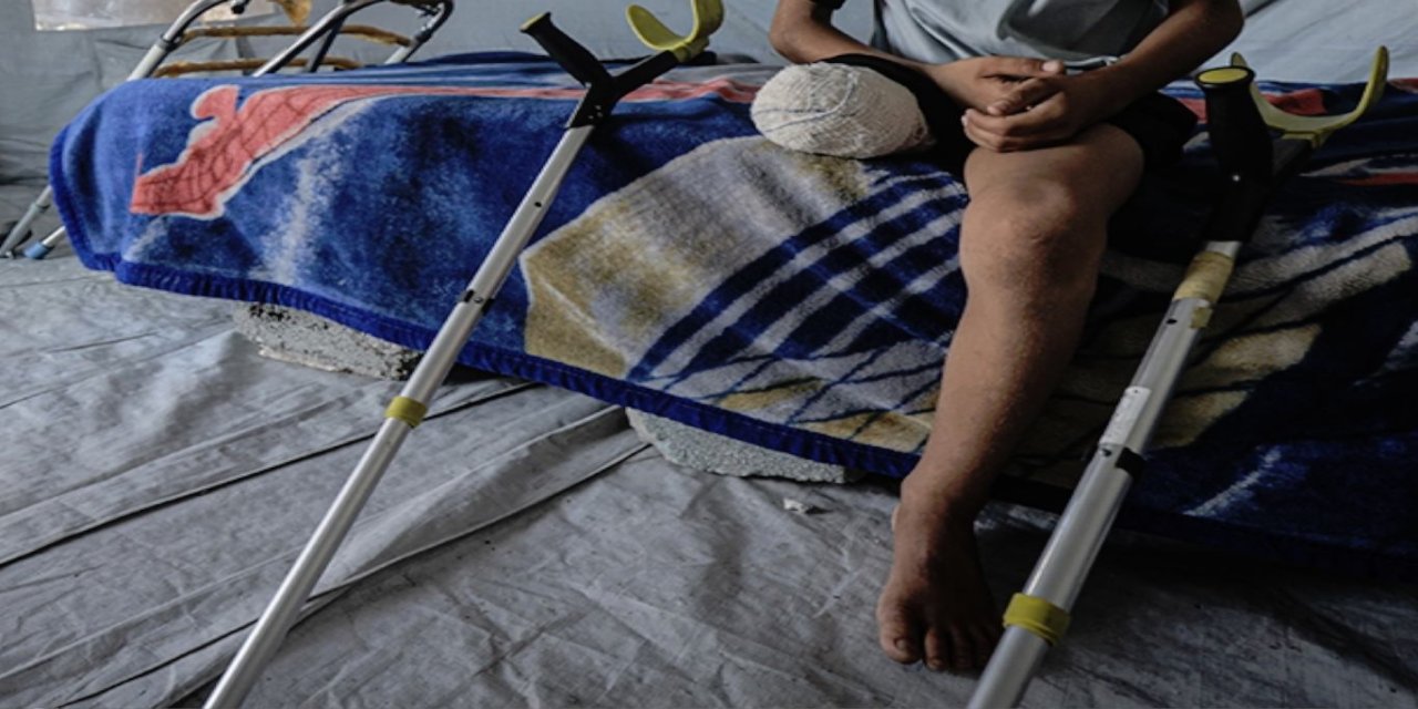 Gazze'de 6 bin ampute vakası acil ve uzun süreli rehabilitasyona ihtiyaç duyuyor