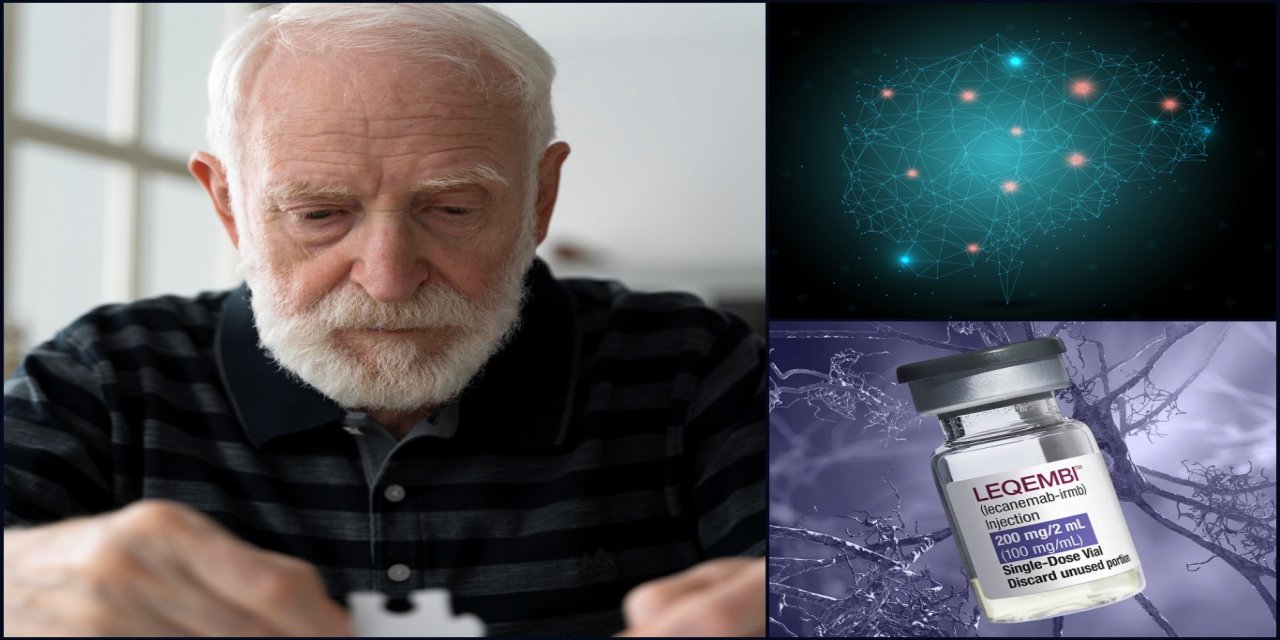 Japon araştırmacılar: Alzheimer ilacı lecanemab, plakları temizlese de beynin ‘çöp temizleme’ sistemini onarmıyor