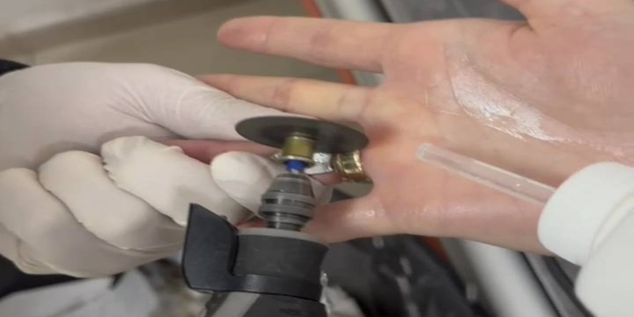 Parmağına sıkışan yüzük itfaiye ekiplerince çıkarıldı