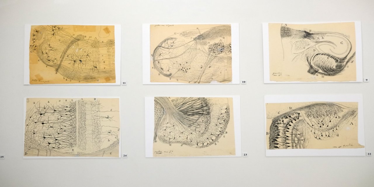 Migrenin kökeni aydınlanıyor: NÖROM’dan bağırsak–beyin eksenini gösteren çarpıcı bulgular