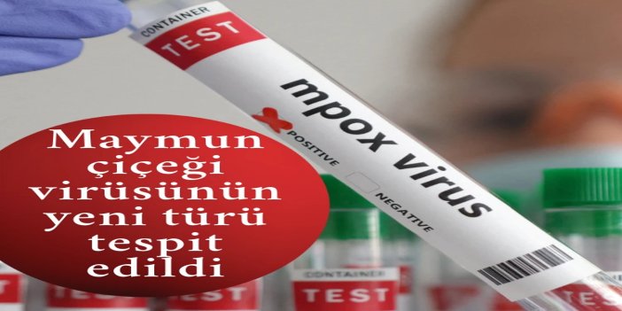 İngiltere’de mpox virüsünün yeni bir türü tespit edildi