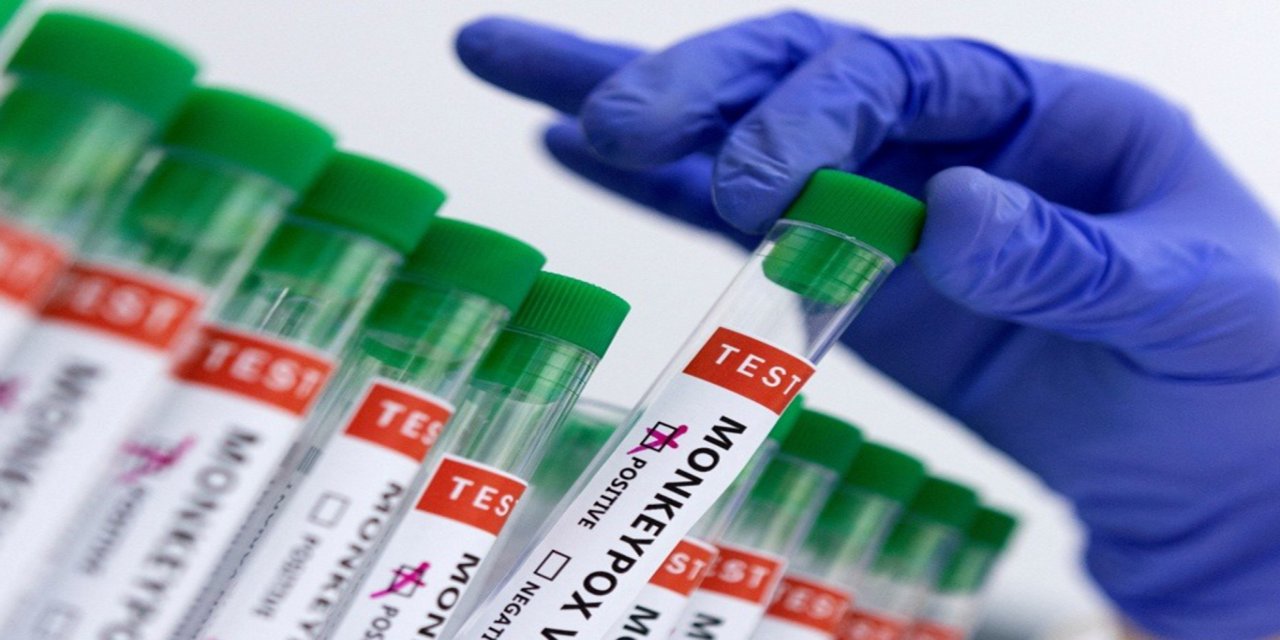 Madagaskar'da M Çiçeği vaka sayısında artış