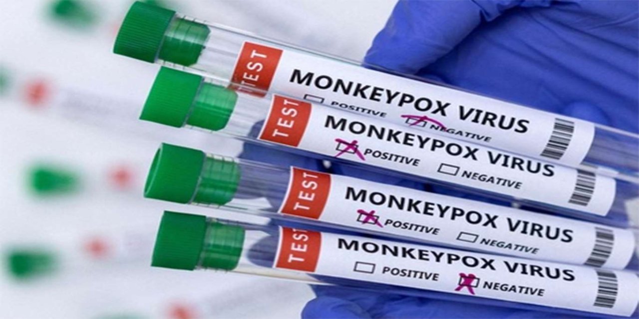 Afrika kıtasındaki mpox acil durum statüsü kaldırıldı