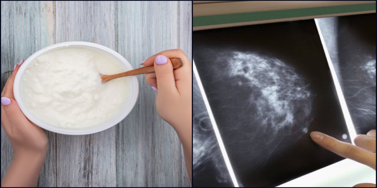 Yoğurt tüketimi meme kanserine karşı koruyucu olabilir mi?