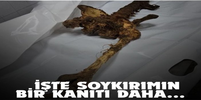 İşgal rejiminin Gazze’de yaptığı soykırımın kanıtları