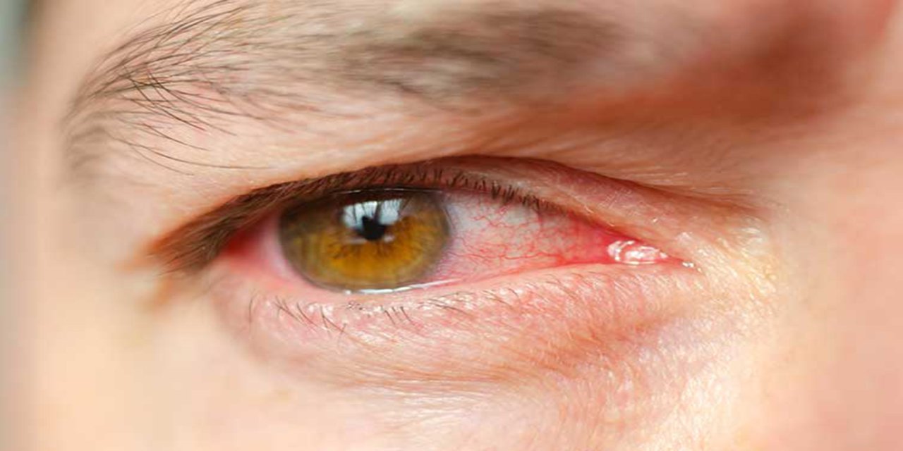 Glokoma karşı erken teşhis uyarısı