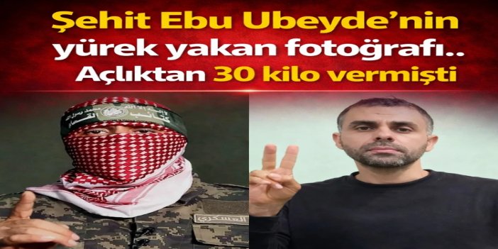 Açlık bedenini eritti ama direnişini kıramadı: Ebu Ubeyde'nin yürek yakan fotoğrafı
