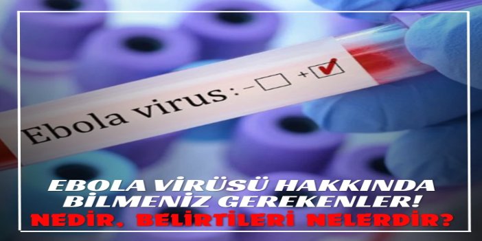 Ebola virüsü nedir,? Ebola virüsünün belirtileri neler?