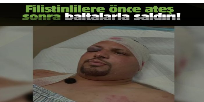 Yahudi çeteler Filistinlilere önce ateş açtı sonra baltalarla saldırdı