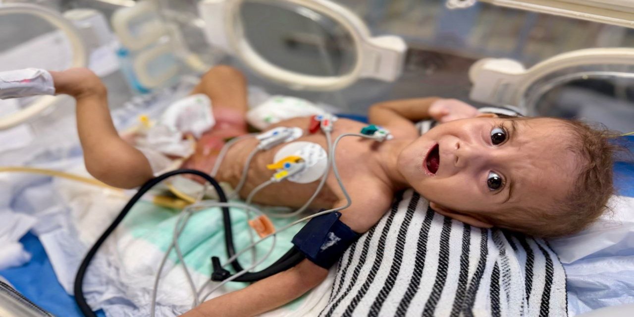 MSF: israilin kısıtlamaları nedeniyle Gazze'de hastaneler çalışamaz halde