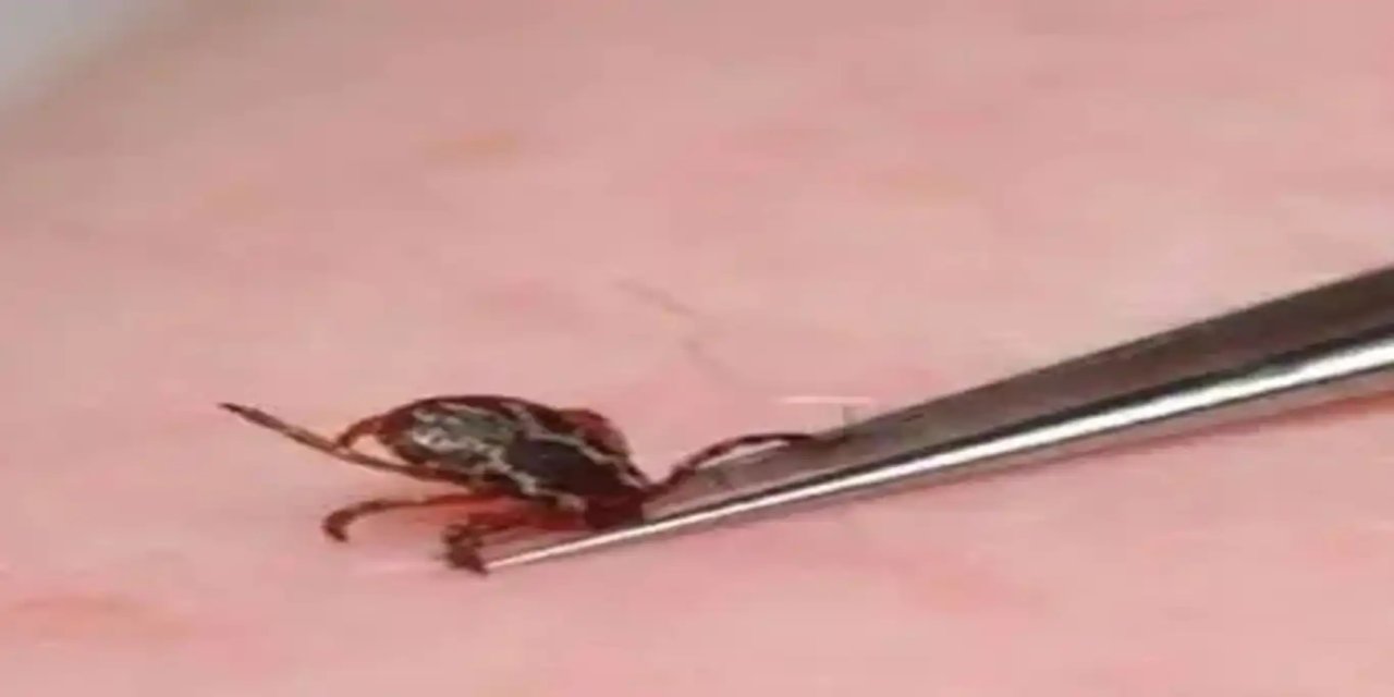 Sivas'ta vücuduna kene yapışan adam hayatını kaybetti