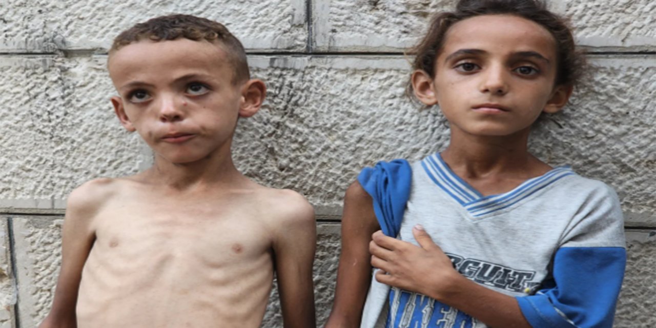 BM'den Gazze uyarısı: Çocuklar yetersiz besleniyor