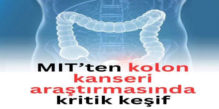 MIT’ten kolon kanseri araştırmasında kritik keşif