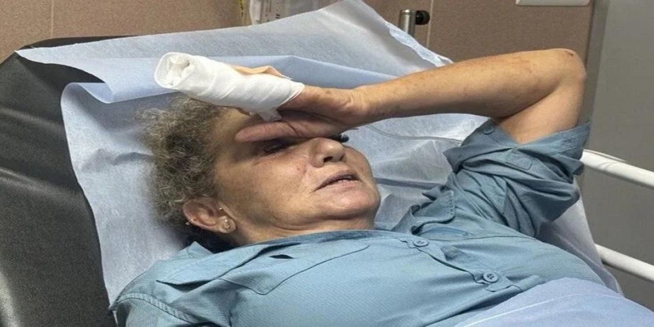 Yahudi çeteler Washington Post foto muhabirini 10 dakikadan fazla tekmeledi