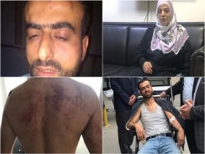 Polis iftar vakti anneyi dövdü, oğluna da işkence etti!