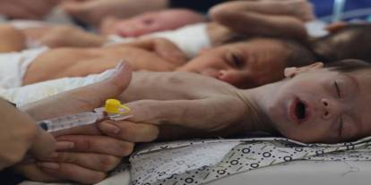 BM: Gazze'de bebeklerin yüzde 92'si açlık tehlikesi altında