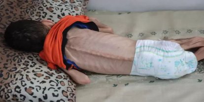 BM: Gazze’de açlık, hastalık ve toplu ölümler kapıda