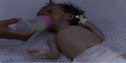 UNICEF: Haziranda Gazze'de 5 bin 800’den fazla çocuk yetersiz beslenme yaşadı