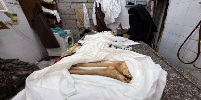 MSF: BM'nin Gazze'deki açlık ilanı sonrası durum değişmedi