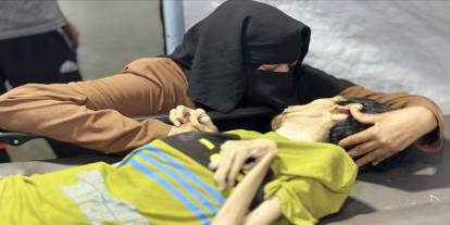 Gazze'de açlıktan ölenlerin sayısı 376'ya yükseldi