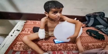 Gazze'nin tek protez merkezi kuşatma ve kaynak yokluğuyla mücadele ediyor