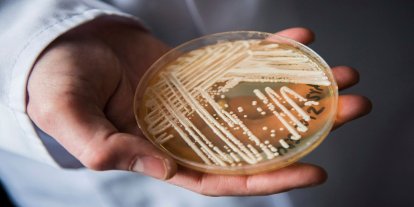 Yunanistan'da candida auris mantarı vakalarında artış