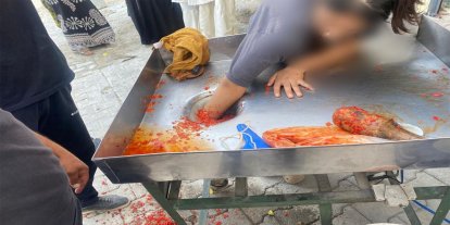 Şanlıurfa’da salça makinesine eli sıkışan genç kız kurtarıldı