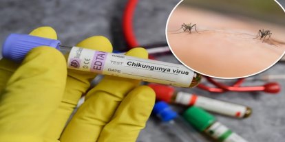 ABD'de chikungunya vakası görüldü