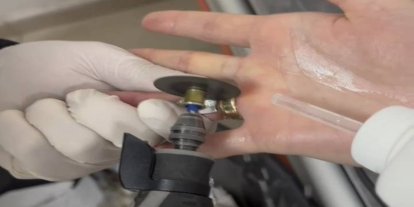 Parmağına sıkışan yüzük itfaiye ekiplerince çıkarıldı