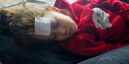 Deyr el Belah ve Cibaliya'da siyonist saldırı: İki şehit, çok sayıda yaralı