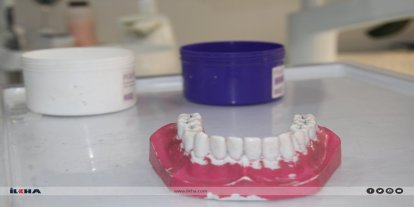 Diş beyazlatmada doğru bilinen yanlışlara dikkat